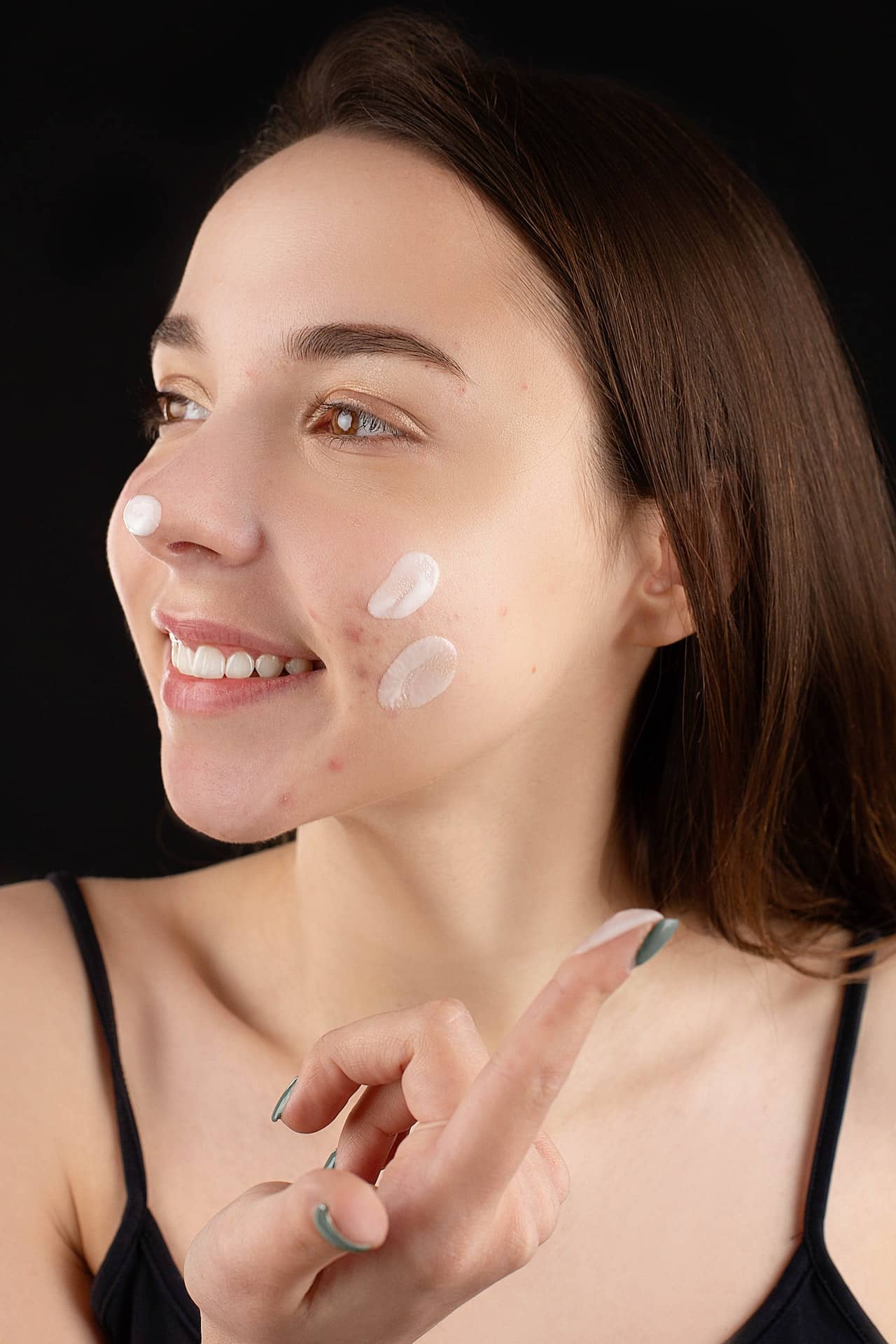 productos-para-eliminar-marcas-acne